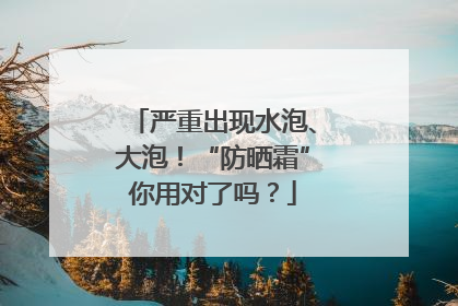 严重出现水泡、大泡！“防晒霜”你用对了吗？