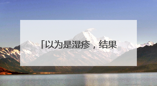 以为是湿疹，结果竟是癌！医生：很多人去错科室！